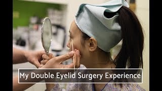 Double Eyelid Surgery with Ptosis Correction  VIP Plastic Surgery Clinic Korea [upl. by Dietz]