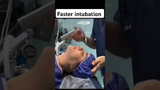 Faster intubation [upl. by Ardnik]