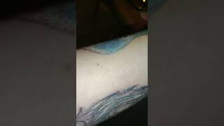 Neatcell Blue light Laser Pen Review and Update on Tattoo Removal [upl. by Streeto]