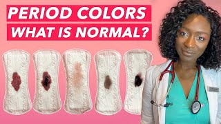 Period Blood Colors Explained  Myths  What It Says About Your Health [upl. by Eerahs567]