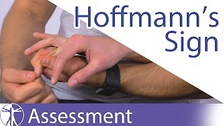 Hoffmanns Sign or Reflex  Upper Motor Neuron Lesion [upl. by Mycah559]