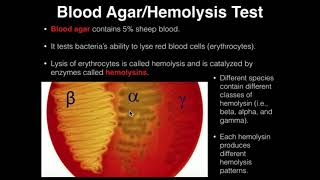 Osmotic Fragility Test  OFT Test  Erythrocyte Fragility [upl. by Eladnek]