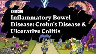 Inflammatory Bowel Disease Crohns Disease amp Ulcerative ColitisPart 1Sketchy MedicalUSMLE Step 2 [upl. by Amarillas]