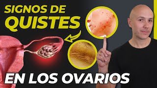 SI TIENES UNO DE ESTOS SÍNTOMAS PUEDES TENER QUISTES EN LOS OVARIOS  ¿CURAR EL OVARIO POLIQUÍSTICO [upl. by Race686]