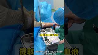 Femoral head necrosis minimally invasive doctor doctorshospital [upl. by Herb]