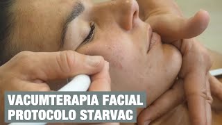 Vacumterapia facial avanzada Protocolo para Profesionales de Starvac [upl. by Elfstan32]