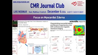 CMR Journal Club December 6 2024 [upl. by Bee]