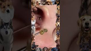 Blackhead Removal  Pore of winer 2024 blackheads [upl. by Chelsey]