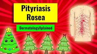 Pityriasis rosea christmastree rash clinical features associations histology and management [upl. by Neelrahc]