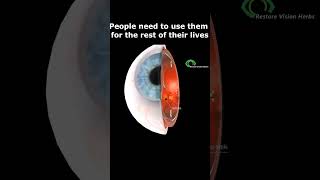 Treatment of Glaucoma  Eye drops [upl. by Grubman]