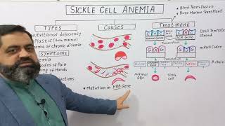 Sickle Cell Anaemia UrduHindi Medium profmasoodfuzail  Sickle cell Disease  Types of Anaemia [upl. by Nnayram444]