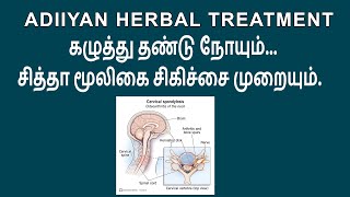 Cervical Spondylitis  கழுத்து சப்ளிடிஸ்  Adiiyan Herbal Treatment Ep 45 [upl. by Einor]