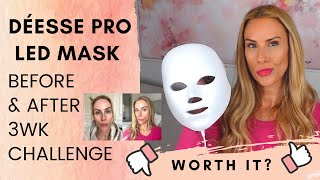 Déese Pro LED Mask  3wks Before amp After  Honest Review [upl. by Okorih]