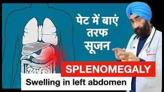 पेट में सूजन हो सकती है स्प्लीन  Splenomegaly  Swelling in Spleen  DrEducation [upl. by Lubbi354]