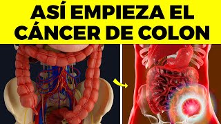 Las 10 PRIMERAS SEÑALES de CÁNCER DE COLON que nunca debes ignorar [upl. by Cullie539]