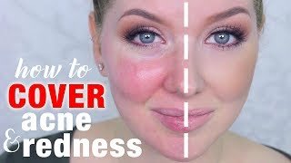 How to Cover Acne amp Redness  DRUGSTORE Makeup [upl. by Arihk]