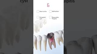 Anatomy quiz  oral pathology in 3D  Have you guessed it right anatomy 3danatomy [upl. by Beghtol]