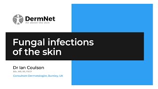 Fungal infections of the skin [upl. by Killion89]