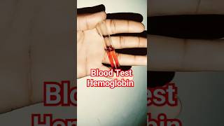 Blood Test Hemoglobin Test THC Greins Under Microscope laboratory [upl. by Ong767]