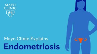 Mayo Clinic Explains Endometriosis [upl. by Jesselyn]