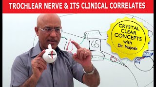 Trochlear Nerve and its Clinical Correlates  Neuroanatomy [upl. by Colet]