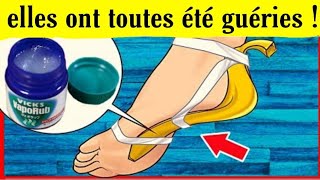 elle applique Vicks Vaporub et peau de banane sou la plante de ses pieds avant de dormir incroyable [upl. by Moth]