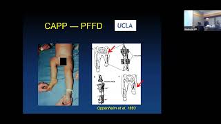 Biomechanics of Human Performance Musculoskeletal Adaption and Injury By Dr Ron Zernicke [upl. by Lind]