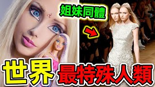 全世界最奇特的10個人類！美女姐妹如何共用身體？第一名堪稱“真人芭比娃娃”，花1000萬整形108次。世界之最top 世界之最 出類拔萃 腦洞大開 top10 最特殊人類 [upl. by Lebazej]