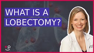 What Is a Lobectomy Dr Cassidy on Lung Cancer Removal [upl. by Hbaruas684]