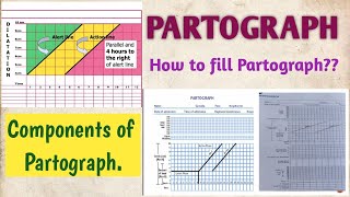 PARTOGRAPH COMPONENTS OF PARTOGRAPH HOW TO FILL OR PLOT PARTOGRAPH [upl. by Kirby]