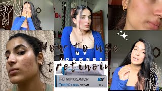 How to use tretinoin 0025 my journeyE2 tretinoin tretinoincream myjourney acnetreatment [upl. by Lj]