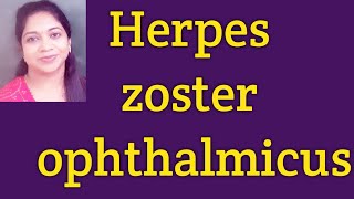 Herpes Zoster Ophthalmicus Hutchisons rulePost herpetic neuralgia Treatment of Herpes Zoster [upl. by Yeorgi828]