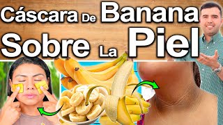 CÁSCARA DE BANANA SOBRE LA PIEL TODOS LOS DÍAS  Para Qué Sirve Y Beneficios [upl. by Acinomaj878]