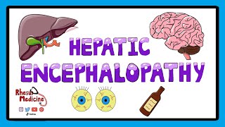 Hepatic Encephalopathy  Pathophysiology Stages and West Haven Criteria [upl. by Ahsiuqat]