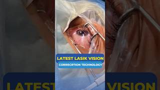 Latest Lasik Vision Correction Technology [upl. by Notlrahc]