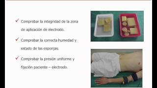 umh1723 201213 Lec015a Electrodiagnóstico de estimulación Metodología de las curvas I  t [upl. by Marmaduke]