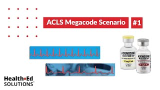 ACLS Megacode Scenario 1 Supraventricular Tachycardia SVT [upl. by Pascia]