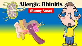 Allergic Rhinitis Runny Nose  Causes Triggering Factors Signs amp Symptoms And Treatment [upl. by Hakkeber]