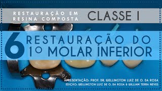 6 Restauração do Primeiro Molar Inferior [upl. by Reginauld]