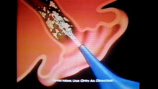 Murine Ear Wax Removal System commercial Family Channel March 10 1992 [upl. by Trabue]