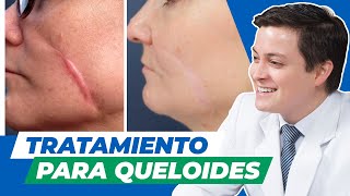 Tratamiento para cicatrices queloides  Clínica Vásquez Lapel [upl. by Milewski]