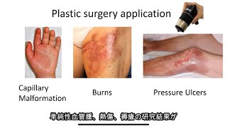 Capillaroscope Essentials 4 Plastic Surgery Research Dr Kento Yamamoto GOKO Webinar for IMC [upl. by Salim]