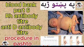 rh antibody titre anti D antibody titre blood bank part 6  rh antibody procedure  in pashto [upl. by Asiela]