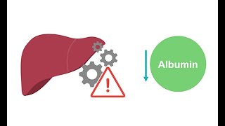 Getting to know albumin physiology [upl. by Giaimo]