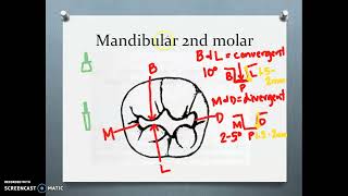 Class I Conventional Cavity Design 47 Beginner Lecture [upl. by Shanley]