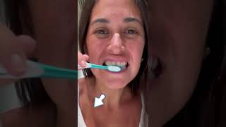 Best Ever Teeth Whitening Formula [upl. by Nirtiac]