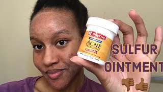 I tried De La Cruz Sulfur Ointment on My Acne [upl. by Dietsche]