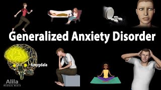 Generalized Anxiety Disorder GAD Animation [upl. by Encrata931]