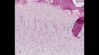 Shotgun Histology Endochondral Ossification [upl. by Silvers]