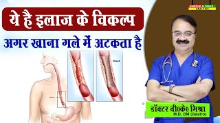 ये है इलाज के विकल्प अगर खाना गले में अटकता है  DYSPHAGEA DIFFICULTY IN SWALLOWING TREATMENT [upl. by Tish]